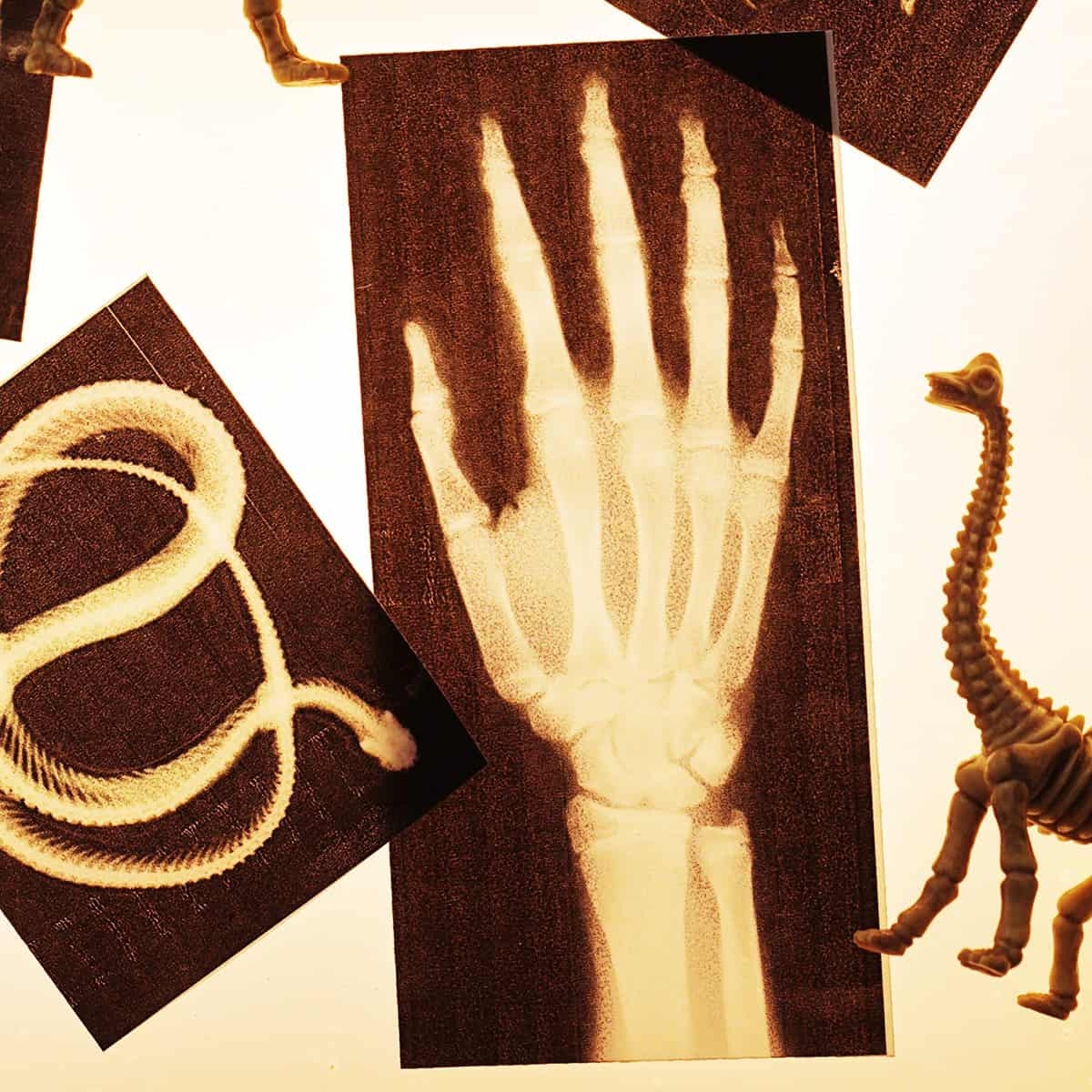 Children s Play X Rays That Can Be Printed At Home 
