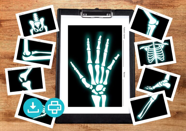 Printable X rays For Kids Pretend Play Kids X ray Activity For